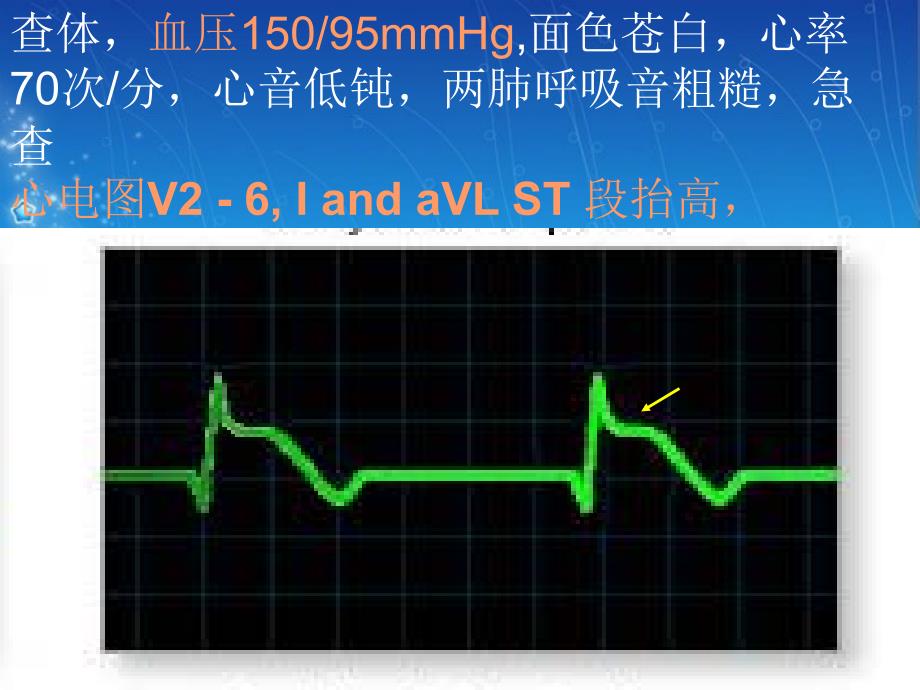 心血管病例讨论(6班2组)_第3页