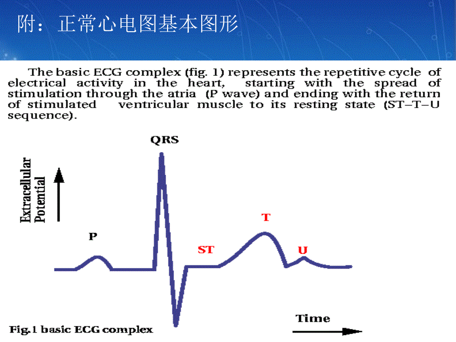 心血管病例讨论(6班2组)_第4页