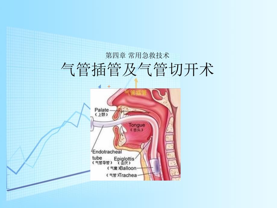 急救护理教学课件作者王卫王辉课件习题及答案04第四章常用急救技术第2节气管内插管术、切开术_第1页