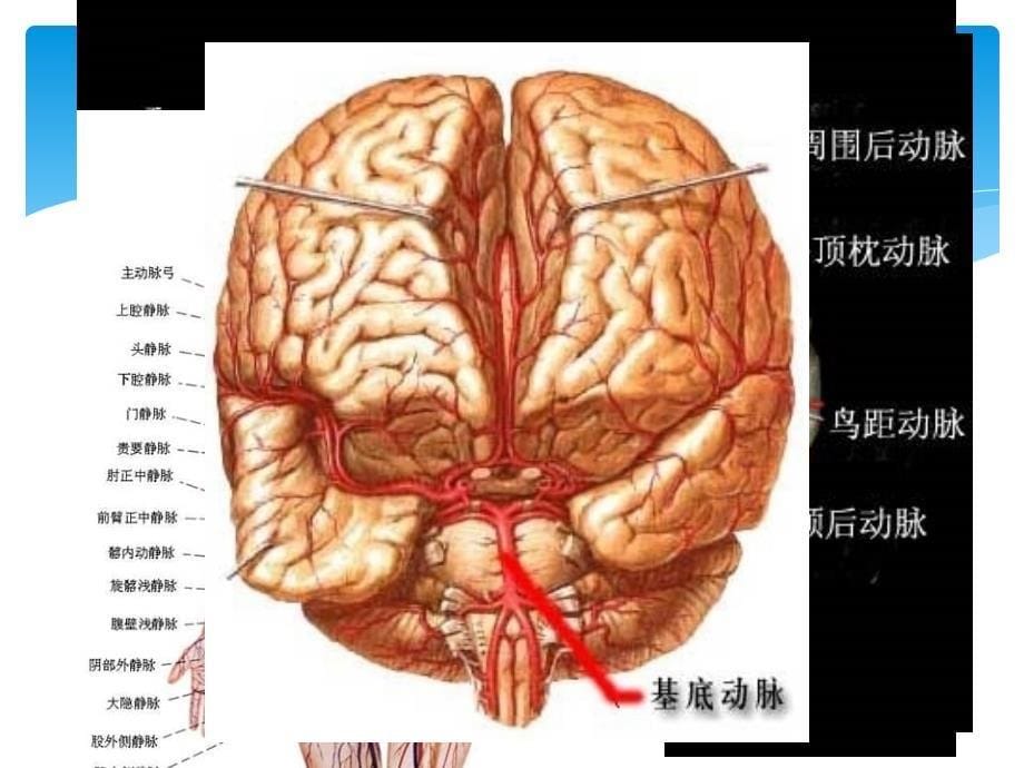 数字减影脑血管造影(dsa)术的护理_第5页