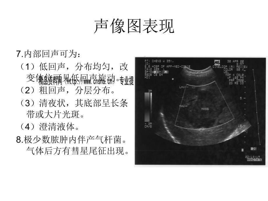 肝脏超声检查纲要_第5页