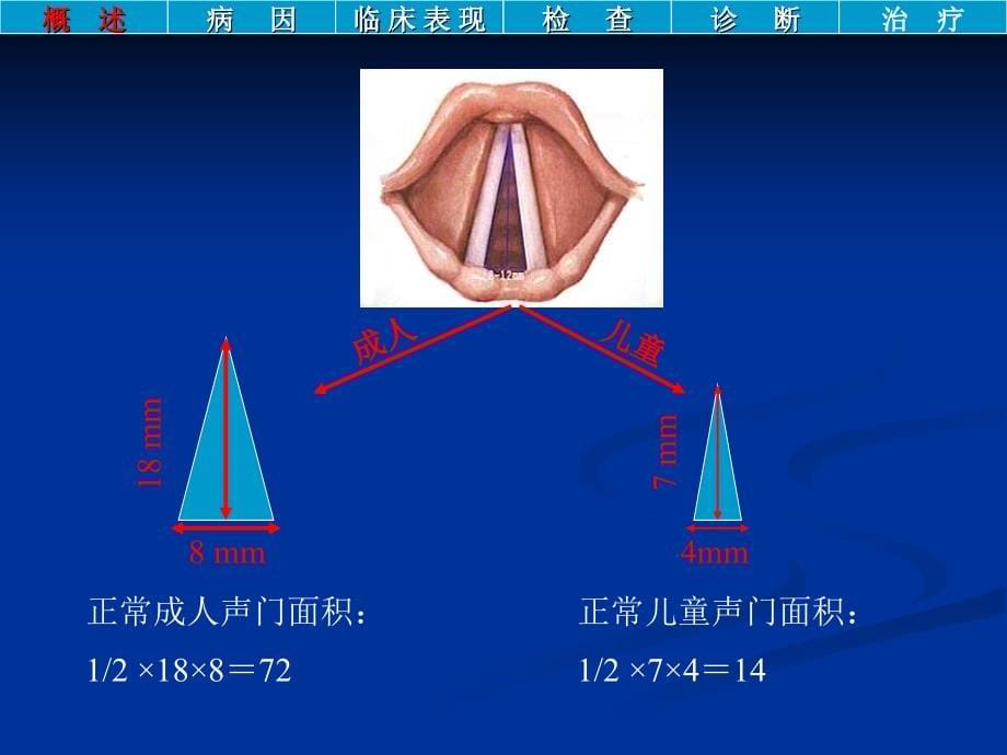 2015喉阻塞及气管切开术_第5页