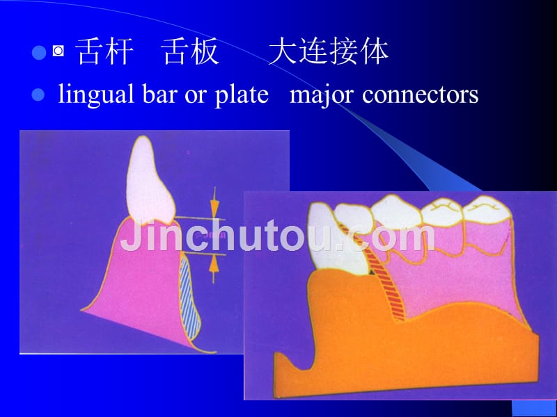 铸造技术_第5页