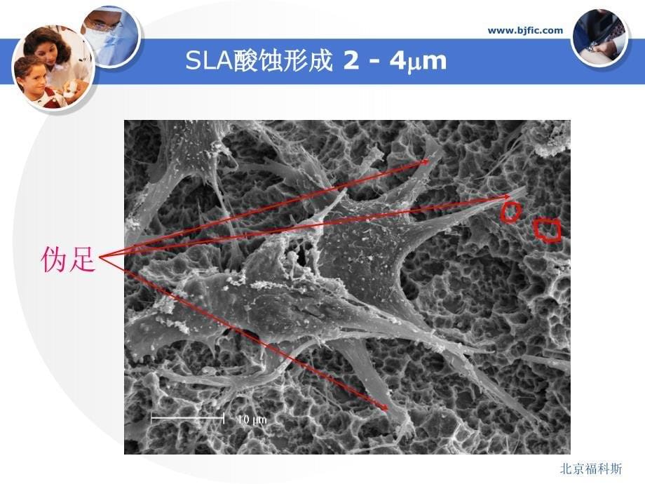 种植患者接诊步骤3.修复及后期维护_第5页