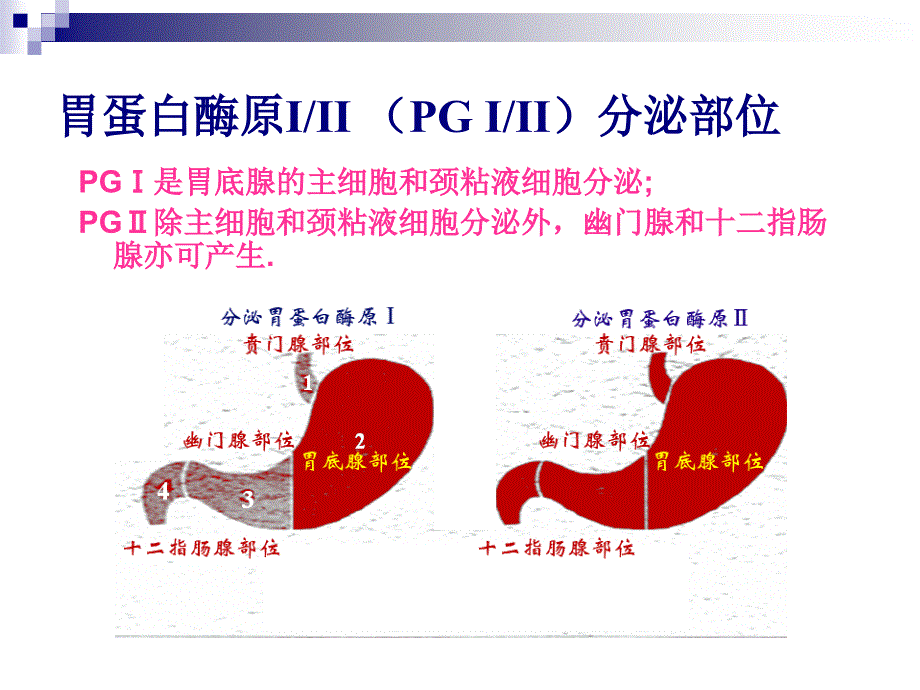 胃蛋白酶原pg临床推广讲义_第4页