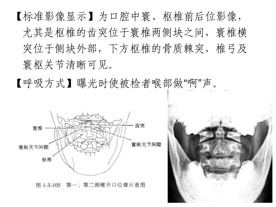 7.脊柱x线摄影技术_第4页