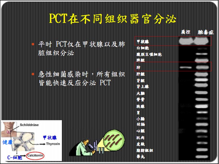 pct降钙素原临床意义_第3页