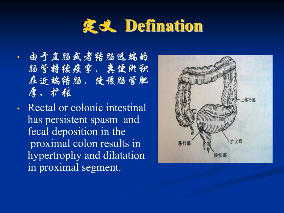 先天性巨结肠与胆道剖析_第2页