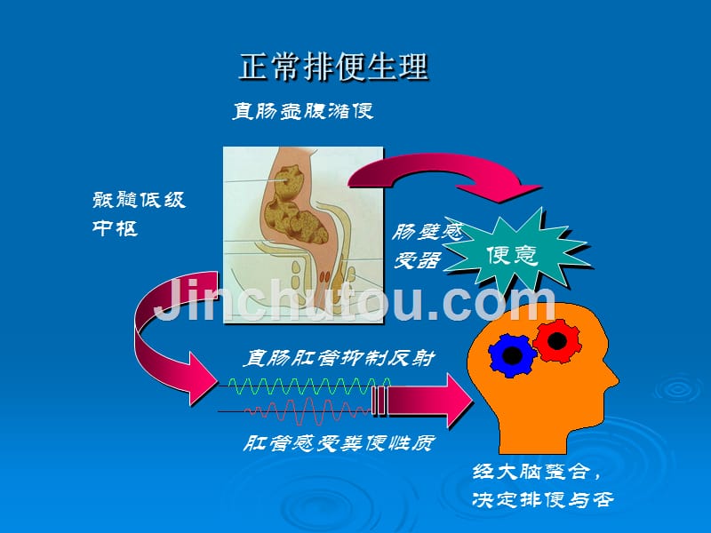 先天性巨结肠剖析_第3页