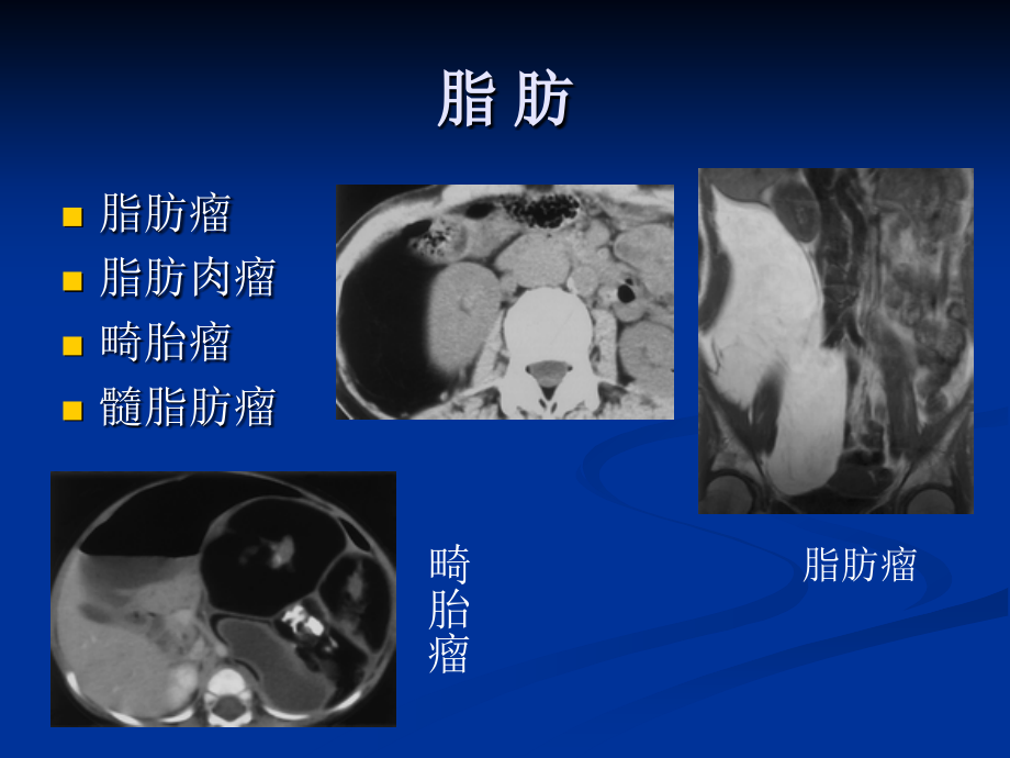 腹膜后ct诊断学(二)_第4页