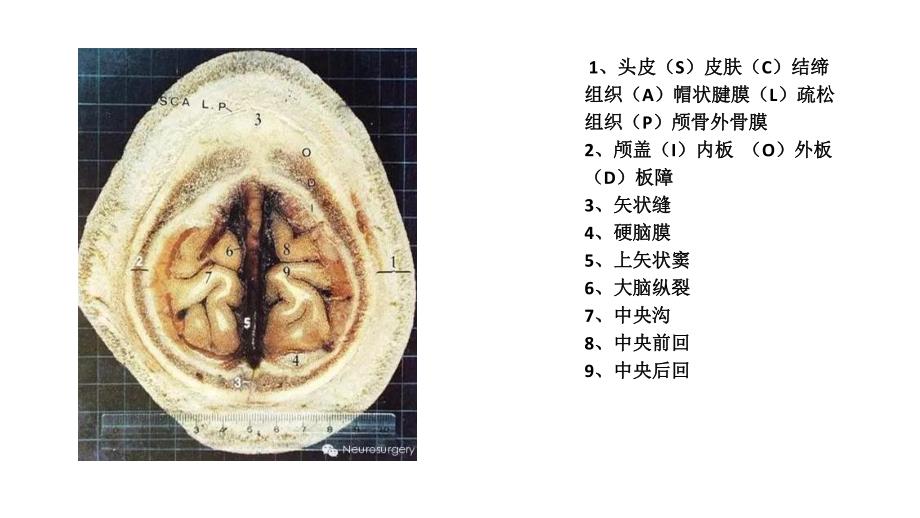 经典颅脑断层解剖图_第3页