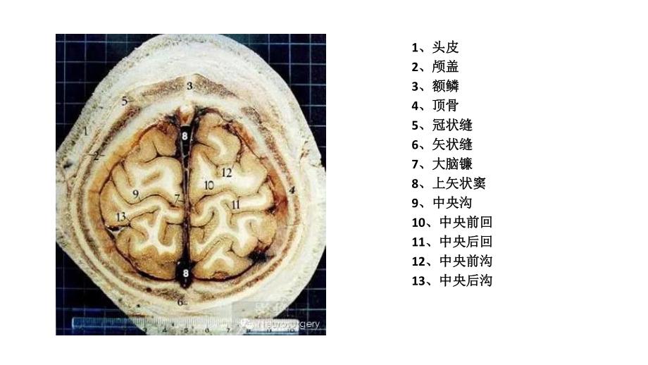 经典颅脑断层解剖图_第4页