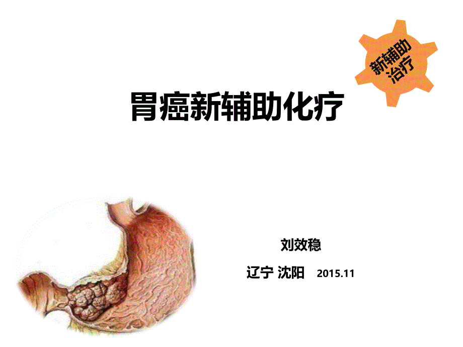 胃癌新辅助化疗201511--最新进展_第1页