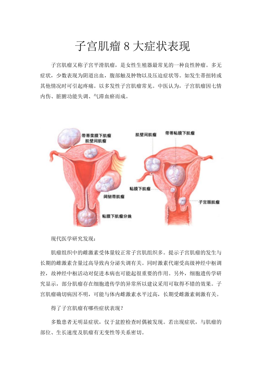 子宫肌瘤8大症状表现_第1页