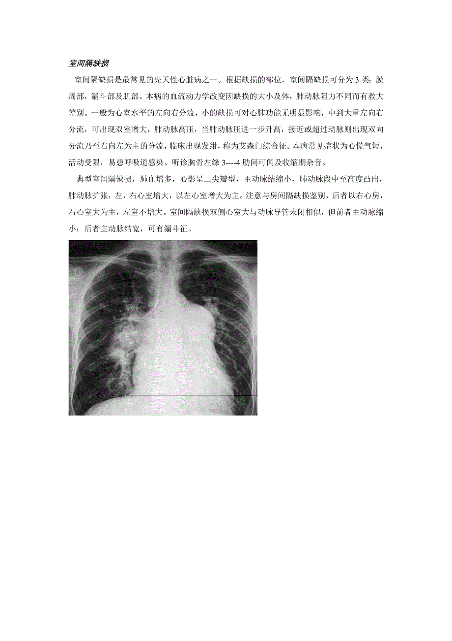 心内科-基本技能-心脏病x线图像的诊断_第3页