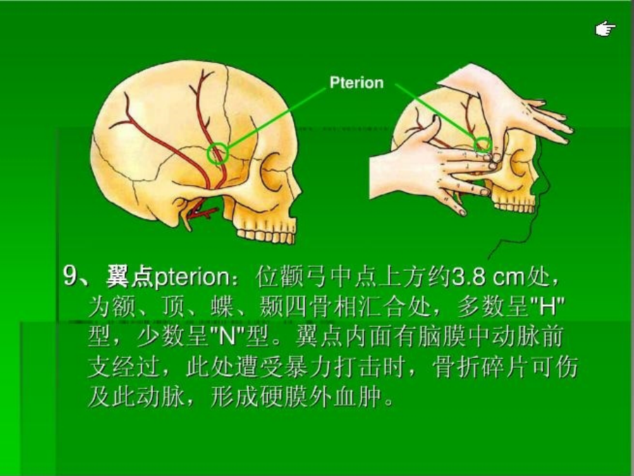 神经外科手术入路(精品) ppt课件_第4页