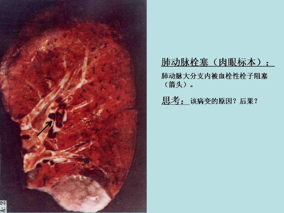 病理学实验涂片重点_第3页