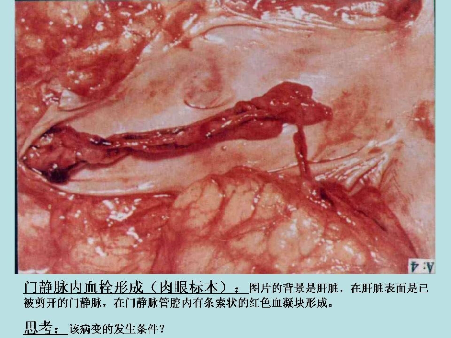 病理学实验涂片重点_第4页