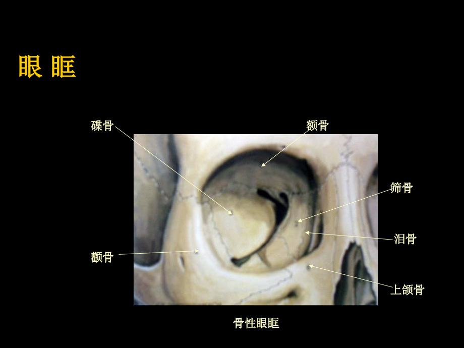 眼眶眼球病变影像诊断._第3页