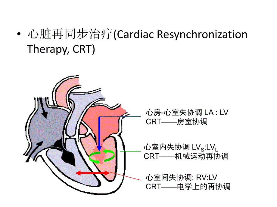 crt适应症和临床研究进展简介资料_第4页