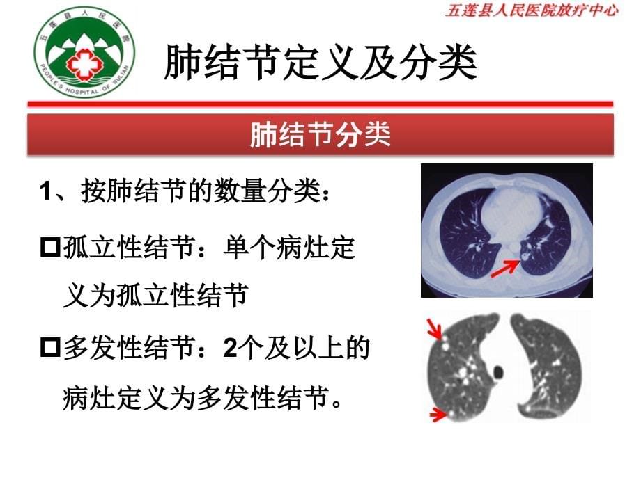 肺磨玻璃结节的评估_第5页