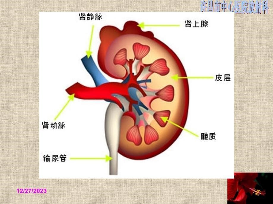 髓质海绵肾-课件_第5页