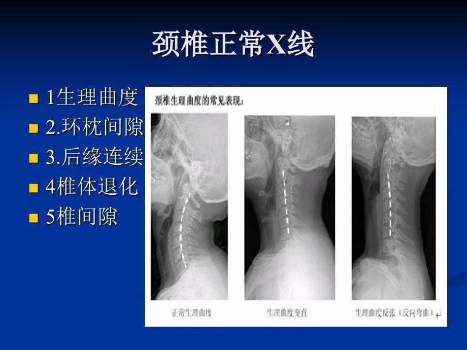 推拿阅片_第5页