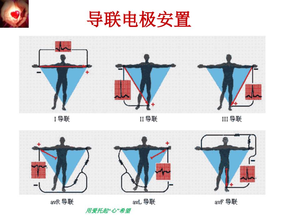 常见心律失常的识别与处理资料_第3页