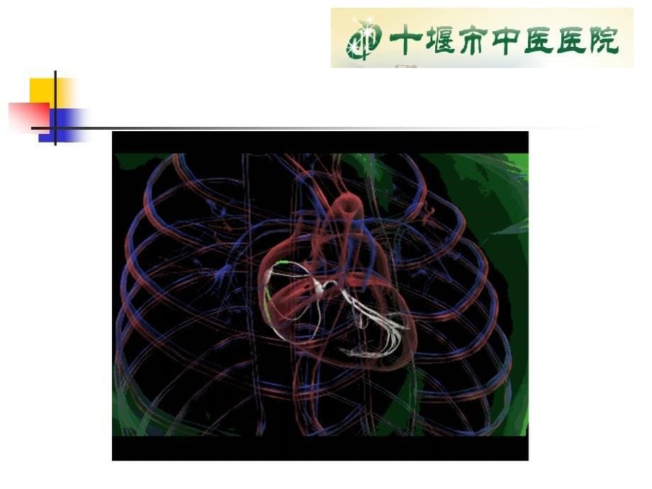 心脏电除颤与电复律术资料_第5页