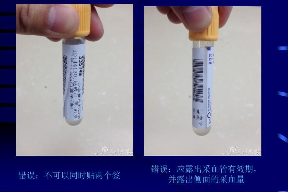 采血管的使用与分类_第5页