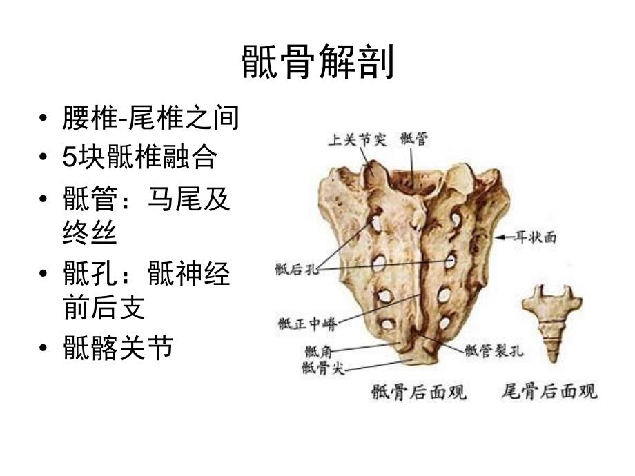 《骶骨肿瘤》课件_第2页