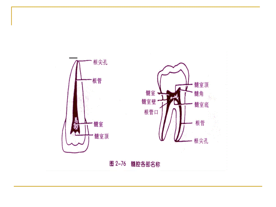 牙体髓腔解剖系统开髓资料_第3页