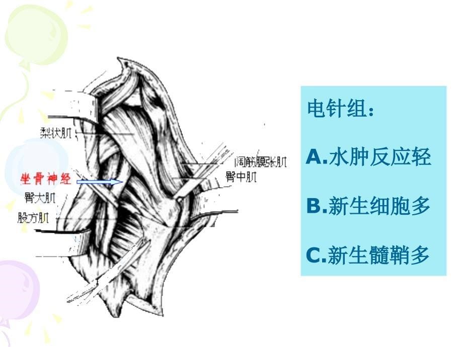 针灸对神经系统功能调节讲座_第5页