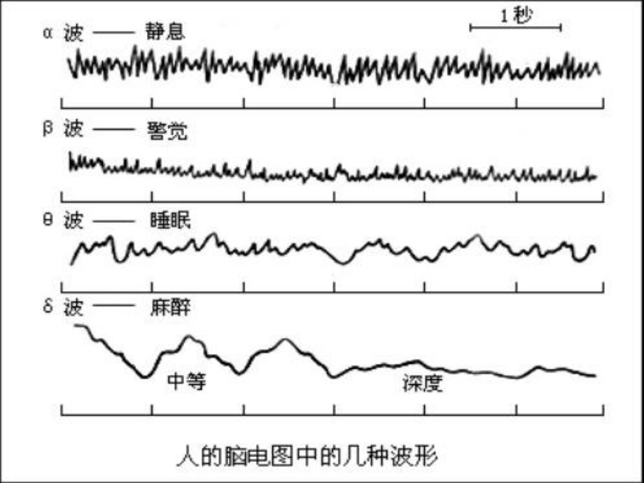 老年人睡眠障碍的特点与诊治资料_第4页