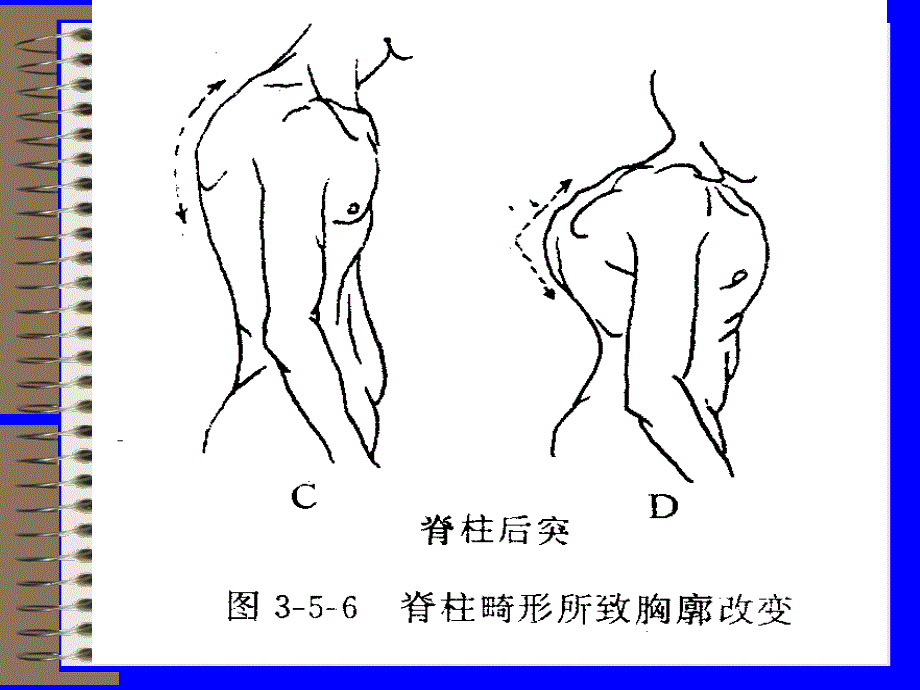 脊柱脊髓损伤的体格检查资料_第4页