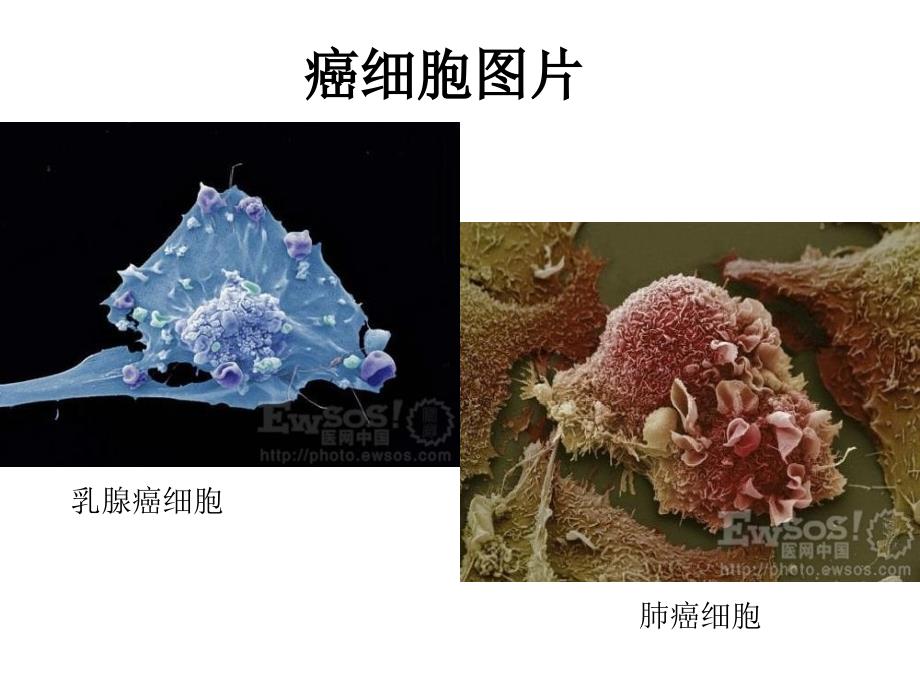 癌症的早诊断及预防1资料_第4页