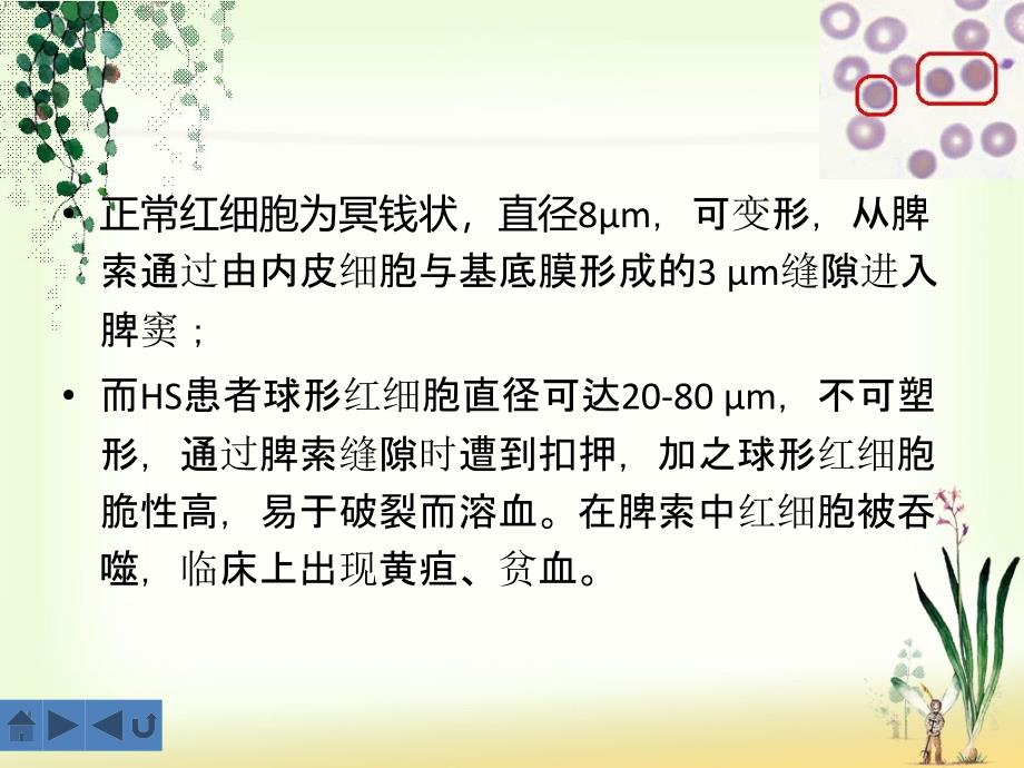 遗传性球形红细胞增多症的诊断及治疗资料_第4页