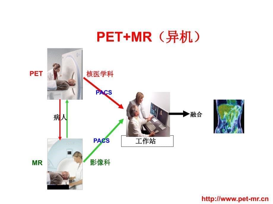 pet-mr核医学大会_第5页