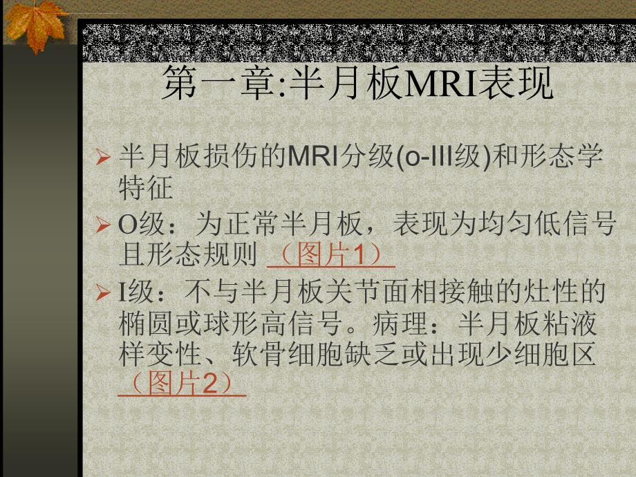 半月板mr演讲稿.ppt_第2页