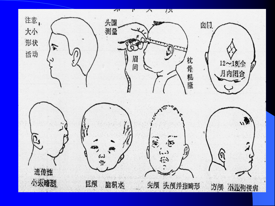 体格检查理论培训_第4页