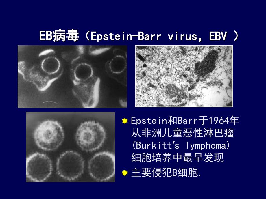 异型淋巴细胞im_第3页