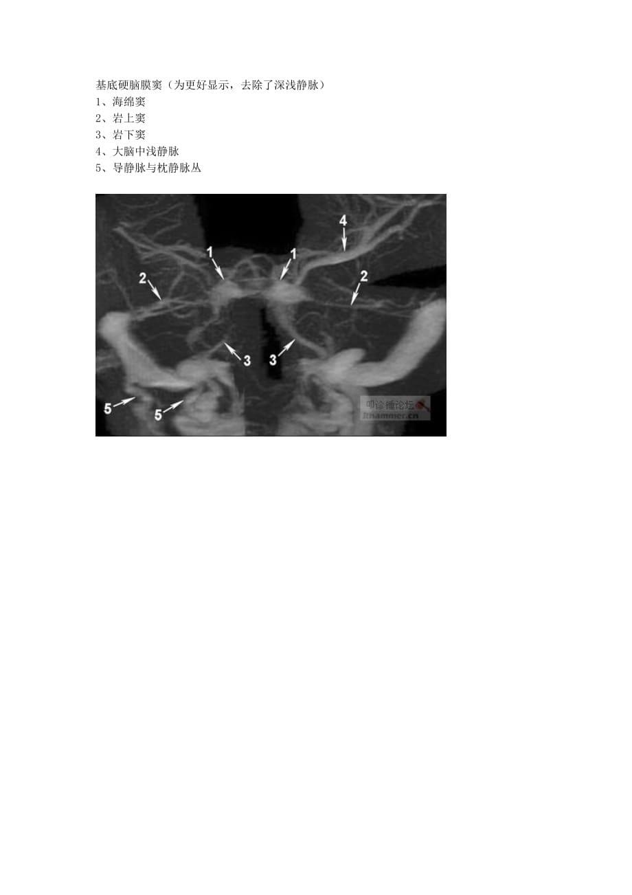 大脑的静脉系统(mrv)_第5页