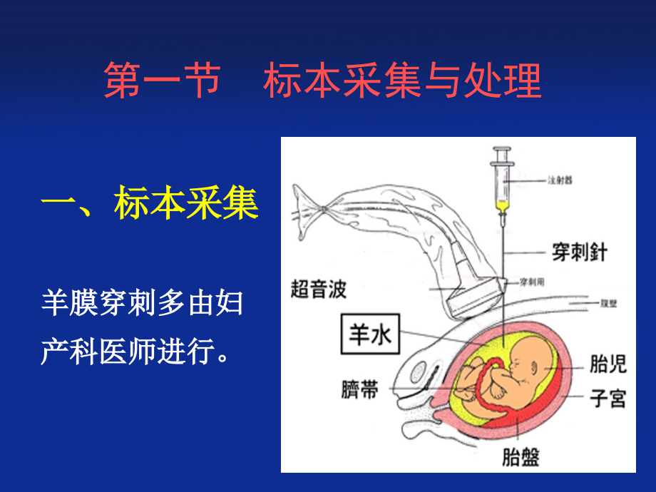 羊水检验_第4页