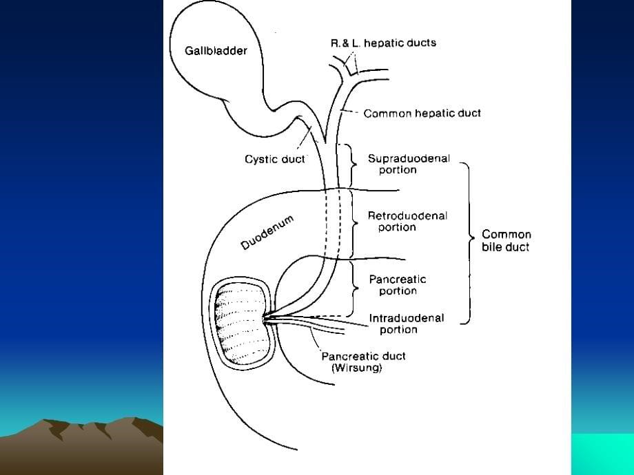 胆道疾病研究生课件_第5页