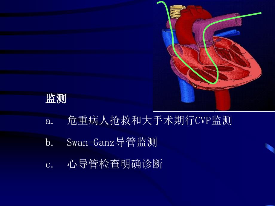 中心静脉穿刺置管术2013_第4页