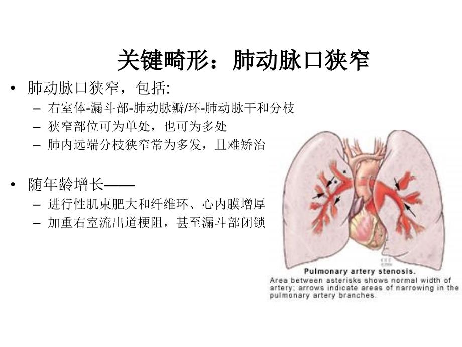 法洛四联症-心律失常_第3页