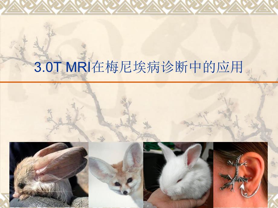 3.0t mri在(内耳)梅尼埃病诊断中的应用_第1页