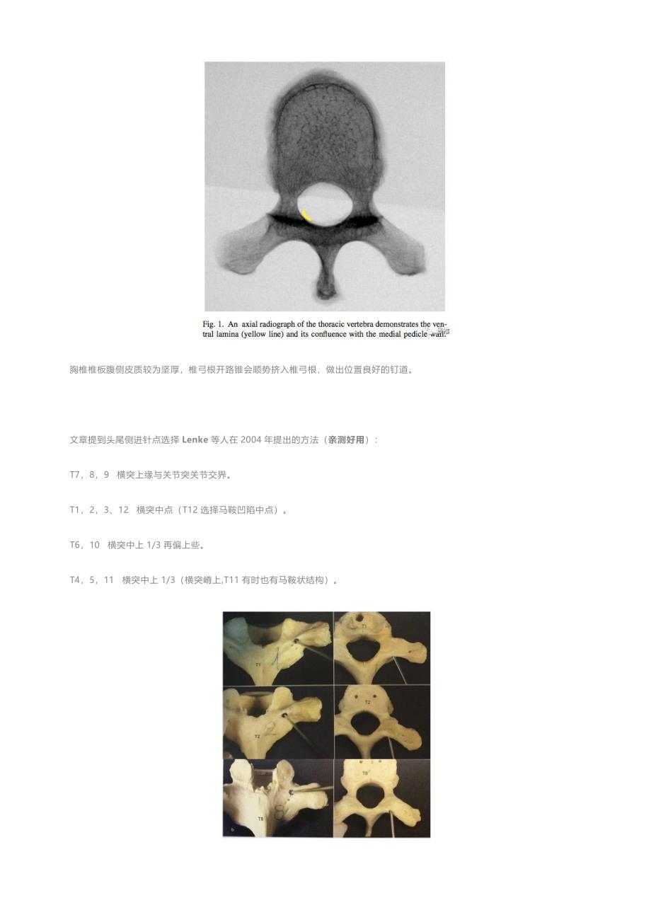 胸椎、颈椎、腰椎椎弓根置钉技术_第2页