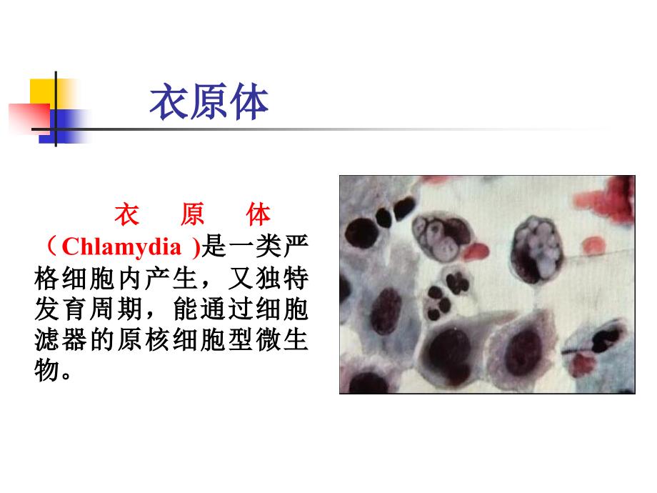 衣原体课件（chlamydia )_第1页