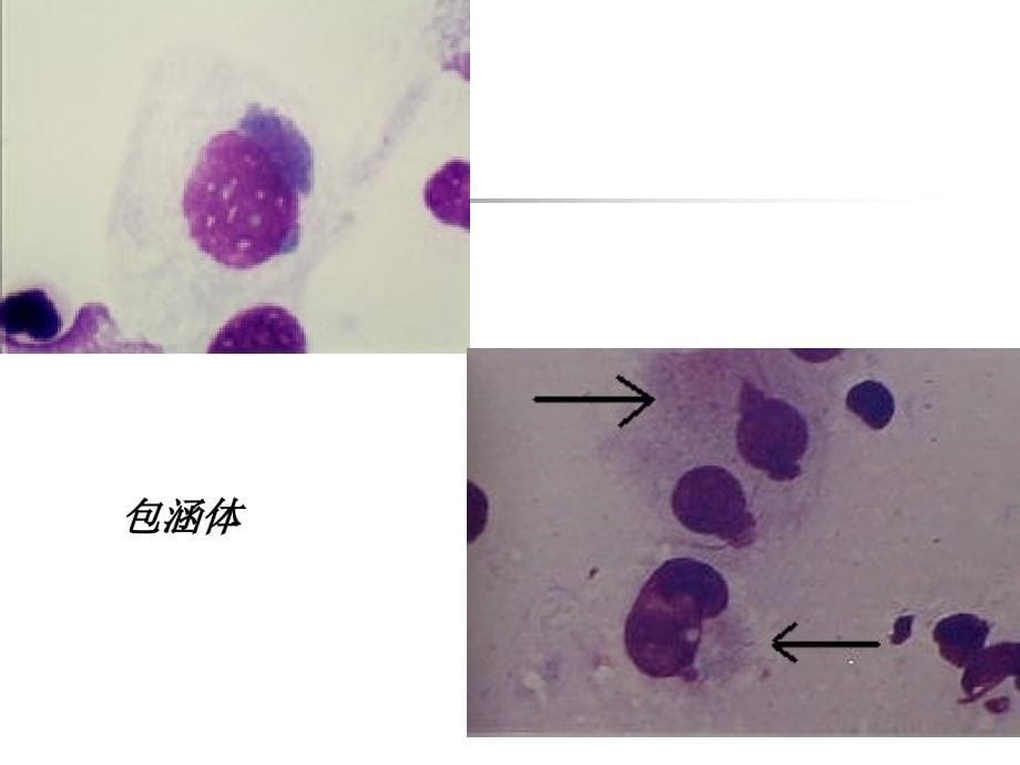 衣原体课件（chlamydia )_第5页